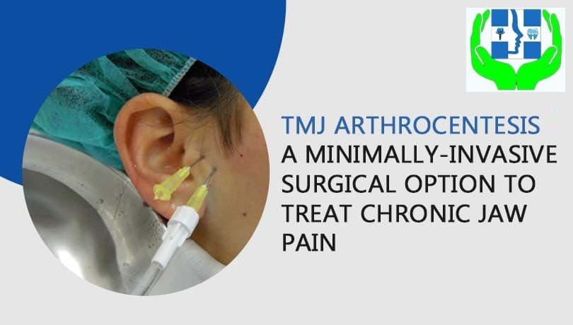Temporomandibular Joint Disorders : Causes, Signs and Treatment at Patna