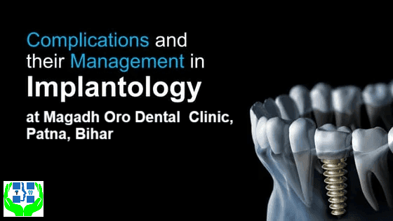 Complications and their Management in Implant Dentistry at Patna