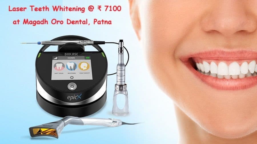 Laser Teeth Whitening : Procedure and Cost in Patna, Bihar