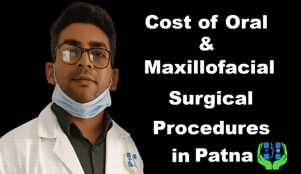 Cost of Oral & Maxillofacial Surgical Procedures in Patna | Magadh Oro Dental