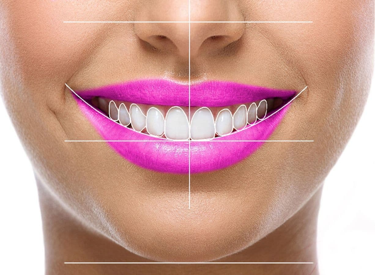Smile Design Treatment in Patna | Magadh Oro Dental