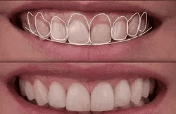 Cosmetic Dentistry: Transform Your Smile with Confidence